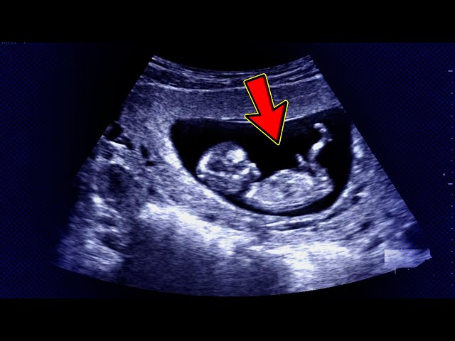حمل الولد شكل الجنين الذكر فى الشهر الثالث