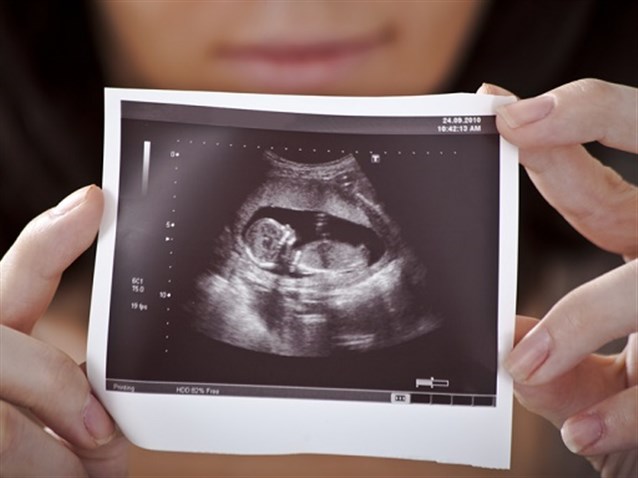 حمل الولد شكل الجنين الذكر فى الشهر الثالث بالسونار